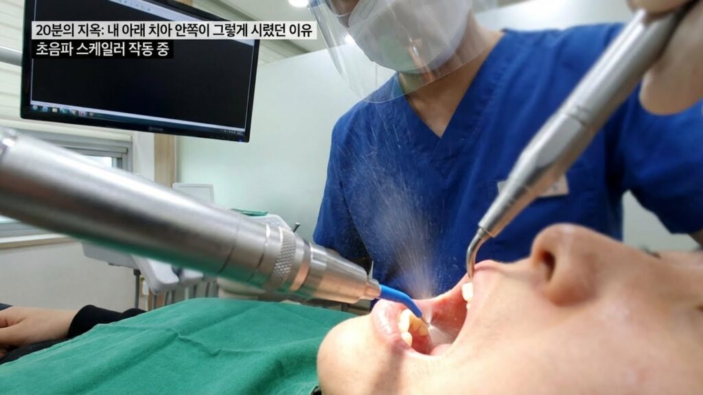 가글마취 초음파 스케일링